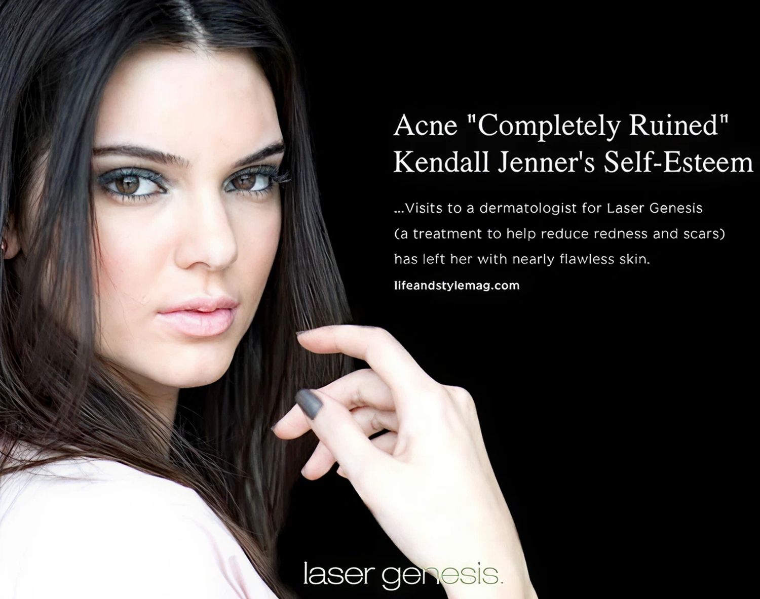 Kendall Jenner discusses acne and skincare treatment.