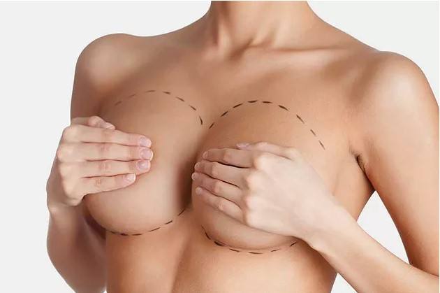 How to Choose Your Breast Implant Size